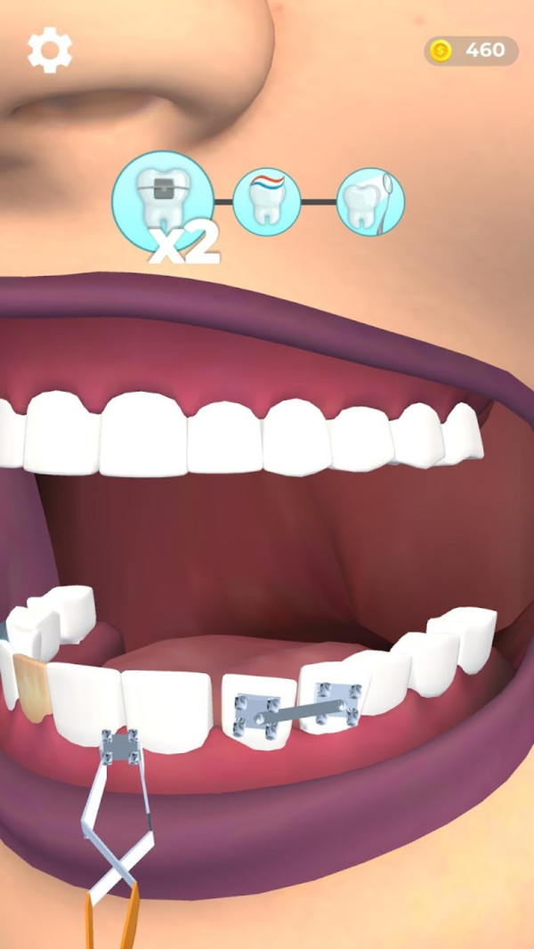 假牙医生游戏安卓版图2: